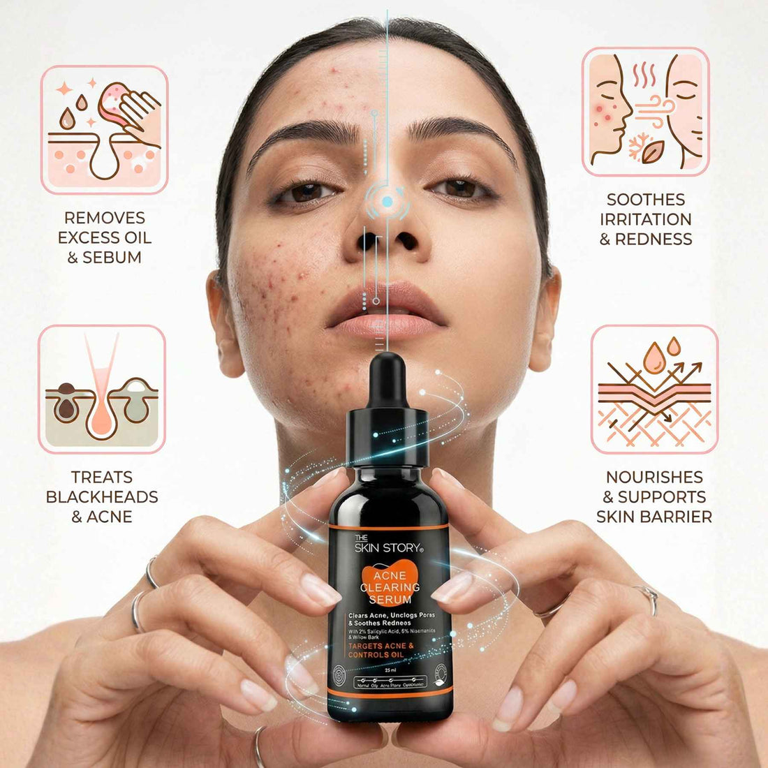 2 Steps PCOD Acne Regime with Facewash & Serums - The Skin Story -