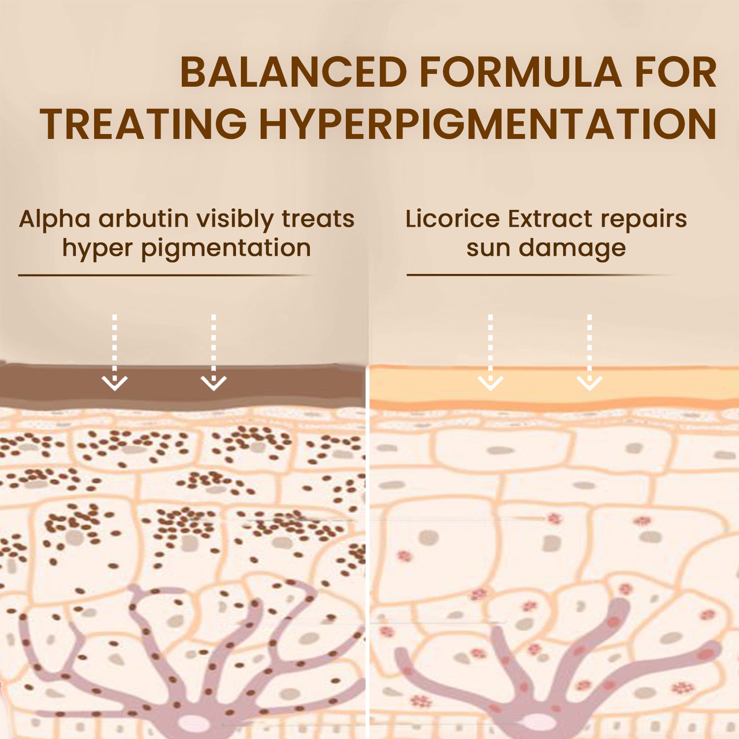 Pigmentation Corrector Serum, Reduces Dark Spots | Anti Pigmentation Serum For Even and Brighter Skin | Comes With a 100% Moneyback Guarantee