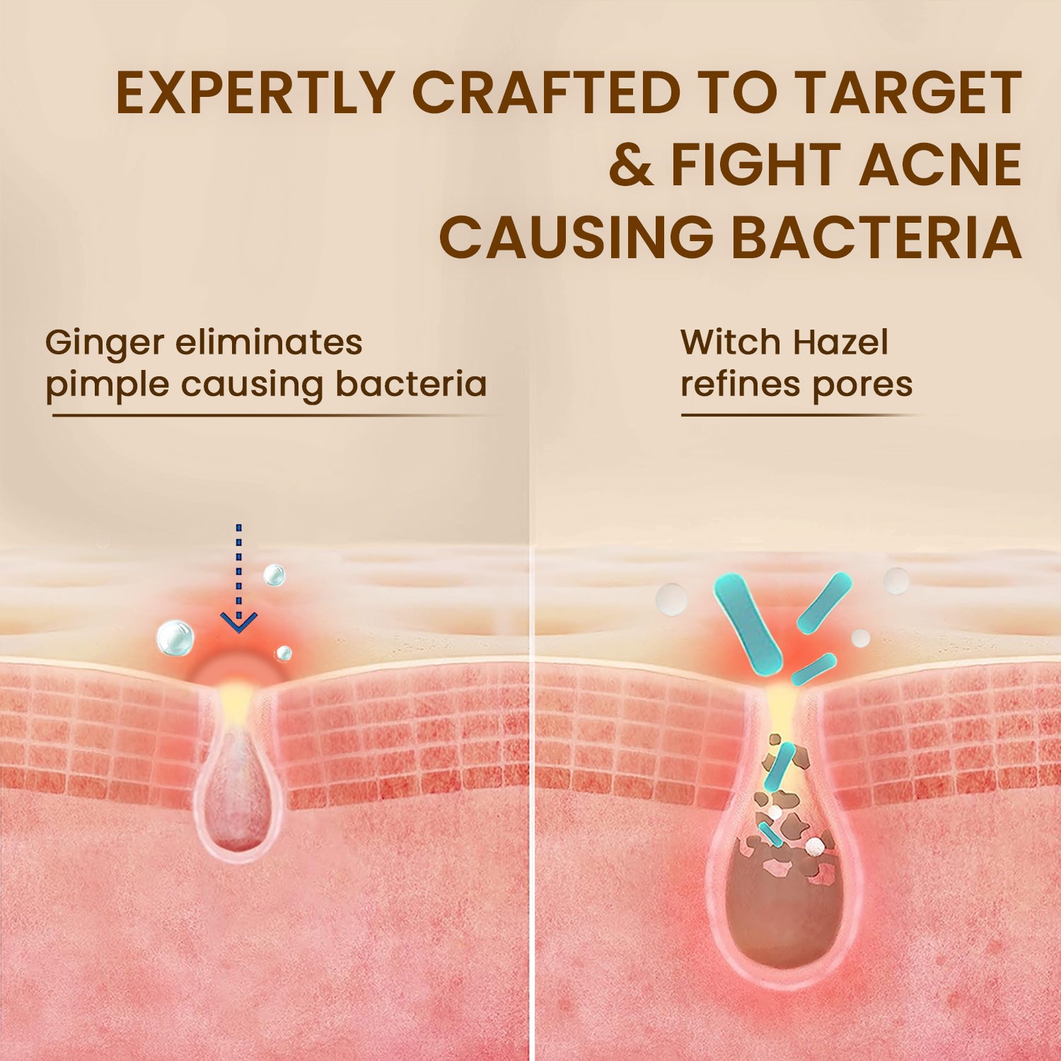 Pimple & Acne Control Facewash | Sensitive Skin, Oily & Pimple Control Skin | Ginger, Cinnamon, Witch Hazel | 100ml