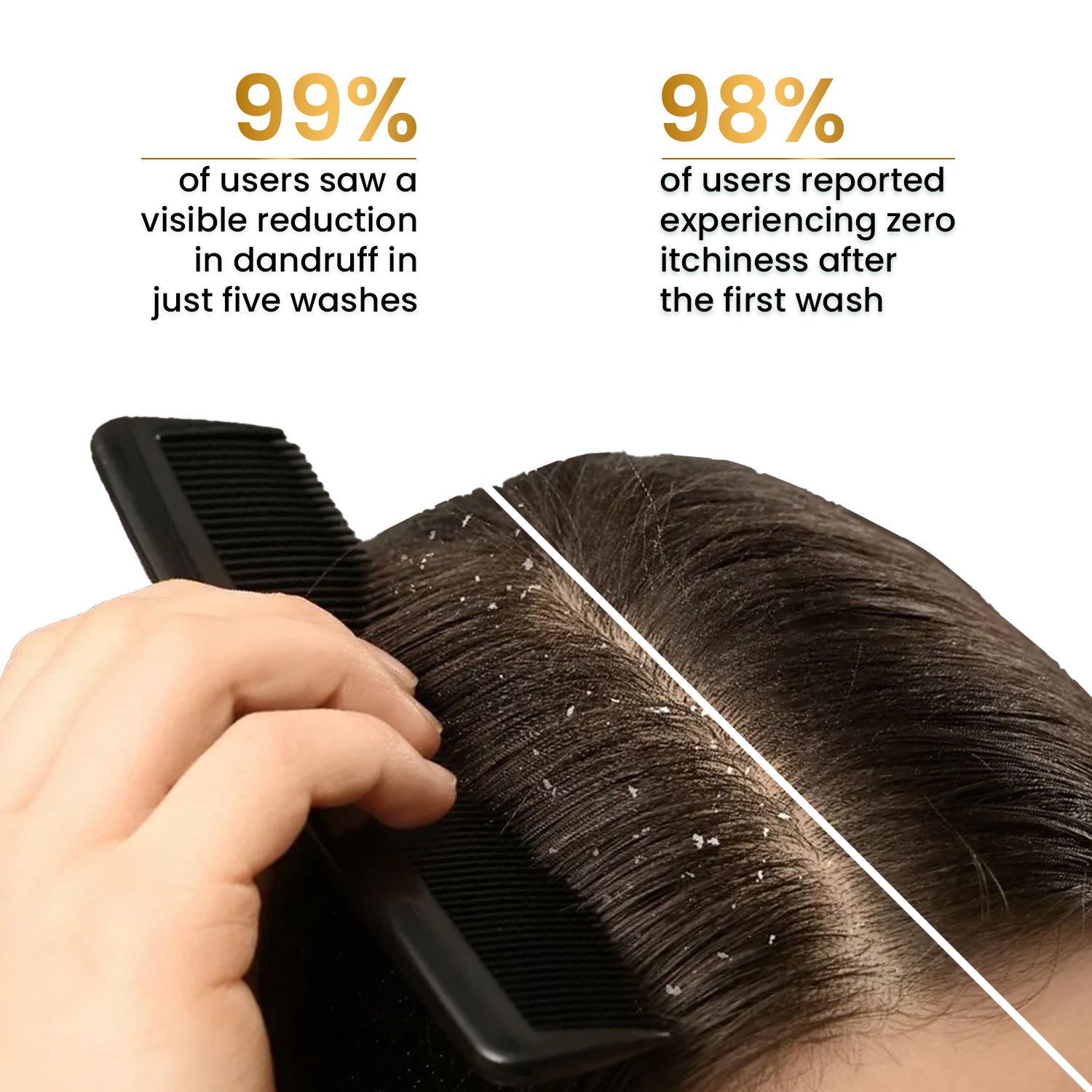 Anti Dandruff Shampoo Flake-Free with 0.5% Climbazole & 1% Niacinamide 250ml