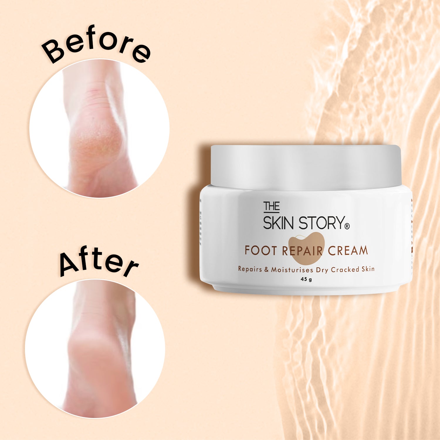 Foot Repair Cream