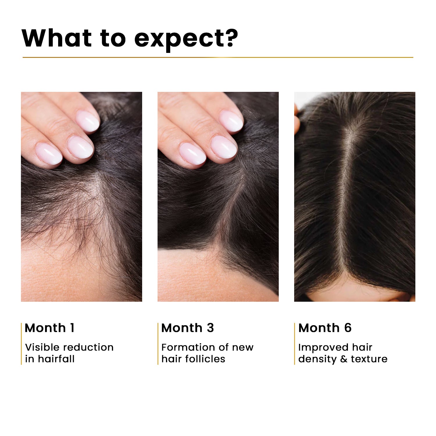 Advanced Hair Growth Serum 3% Redensyl®️ + 2% Rosemarry + 1% Hair Line, 25ml
