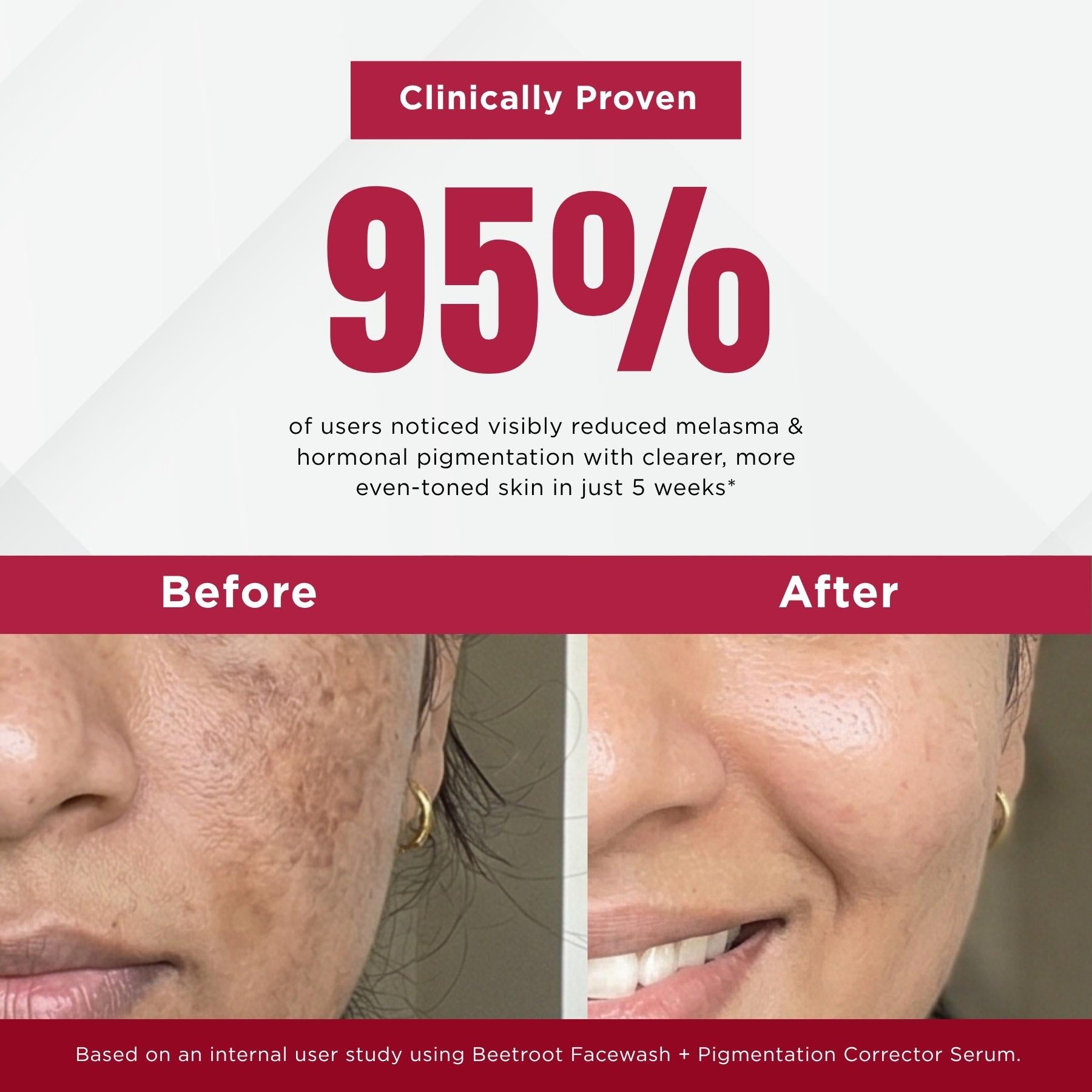 Melesma 2 Steps-Facewash+Serum