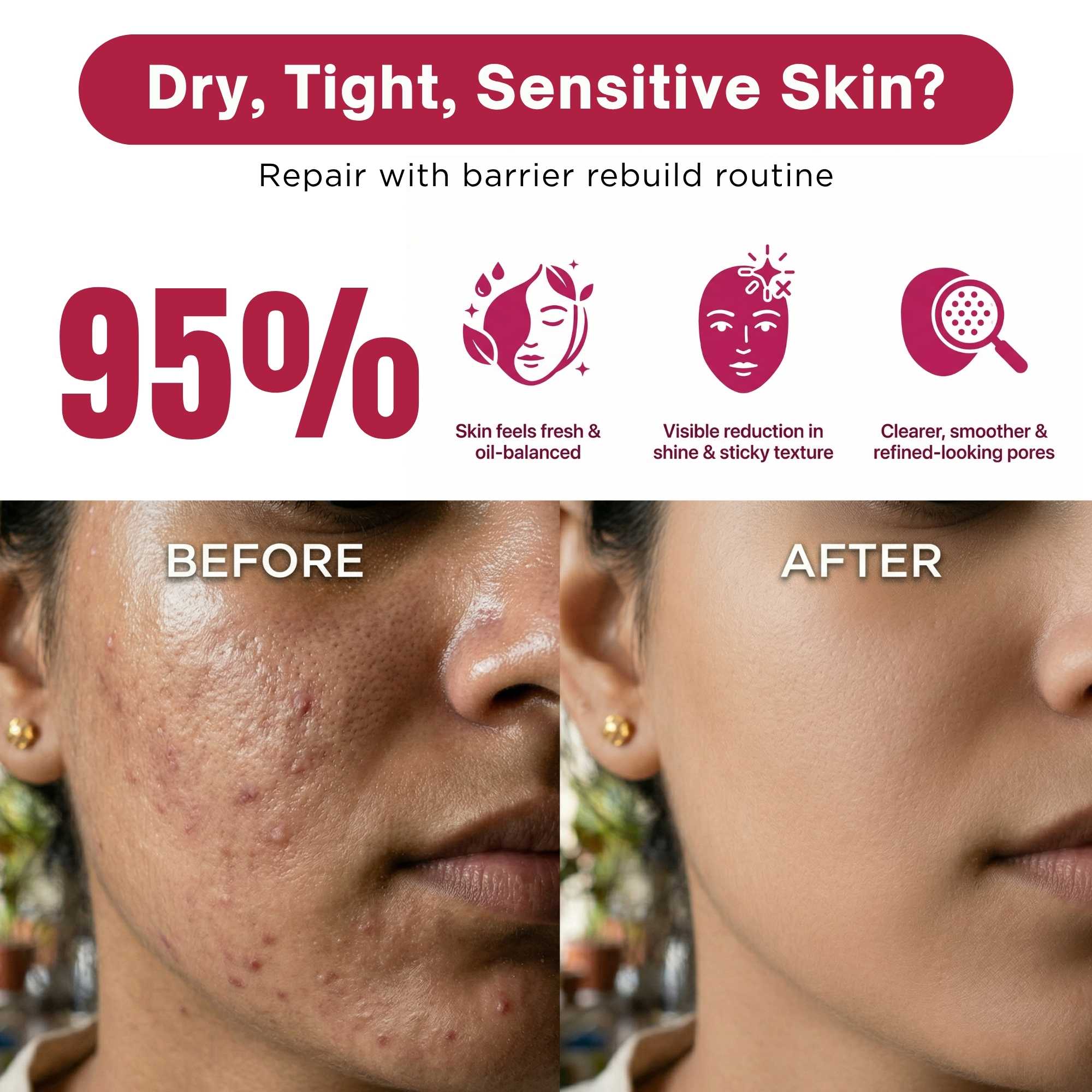 Oil Control 3 Steps-Facewash+Toner+Moisturiser