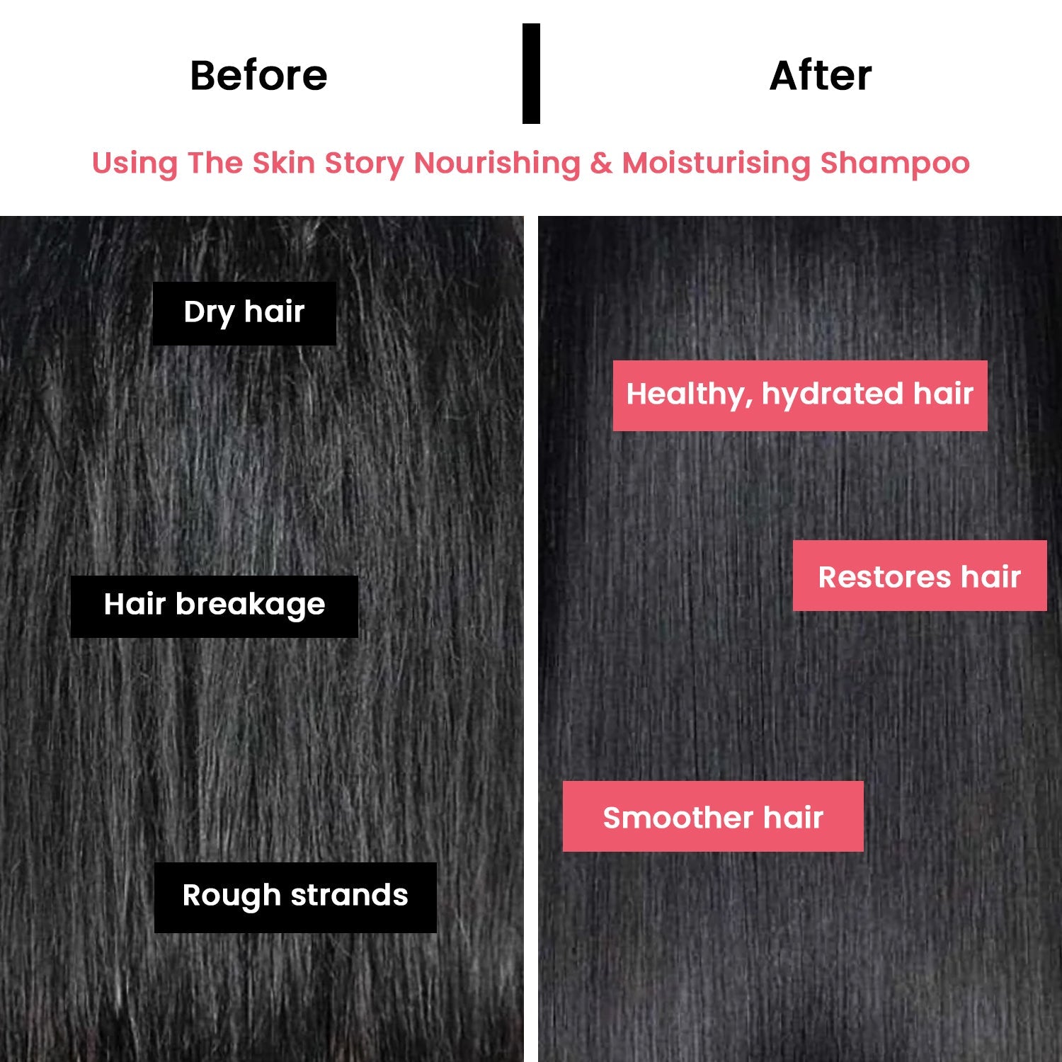 Advanced Hair Fall Combo - The Skin Story - Hair Care Combo