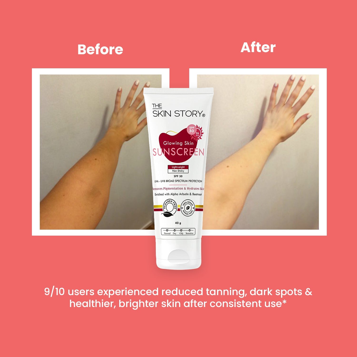 Anti - Pigmentation Combo - The Skin Story - Face Care