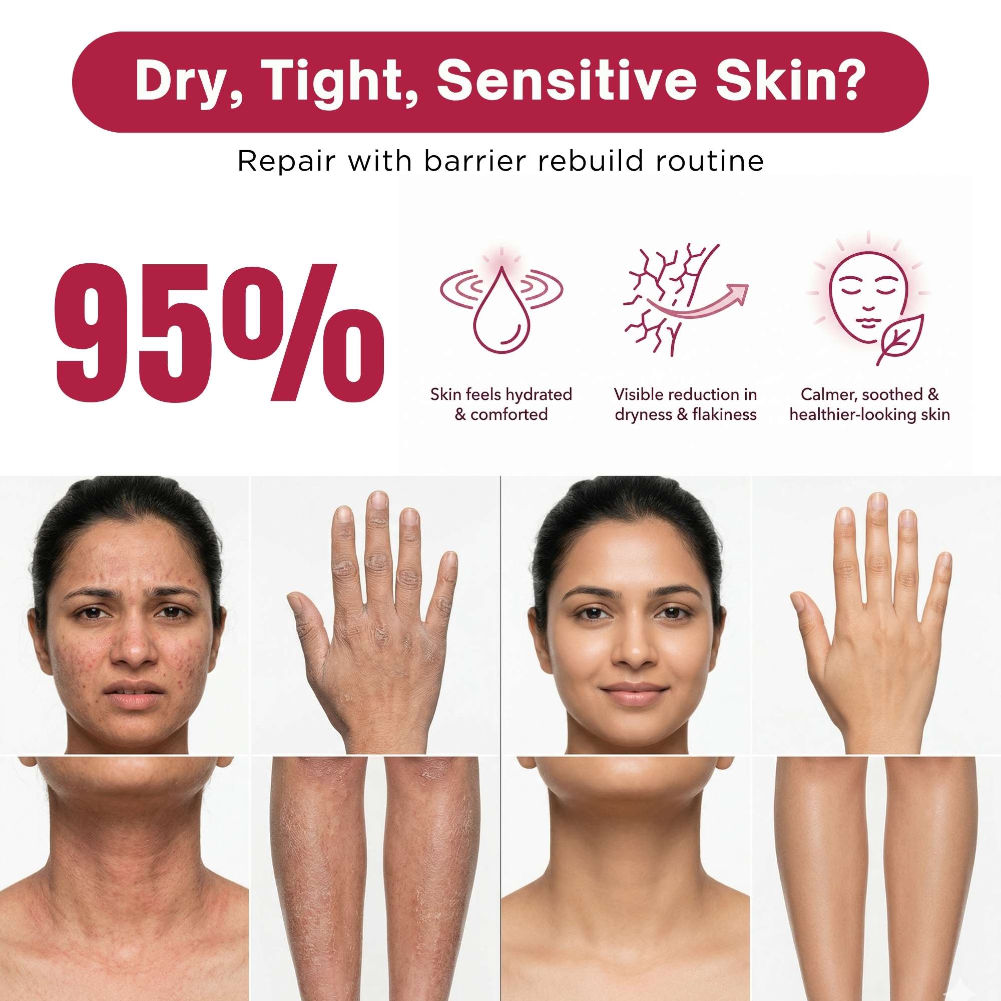 Barrier Rebuild 3 Step - Facewash + Cream+Sunscreen SPF50 - The Skin Story -