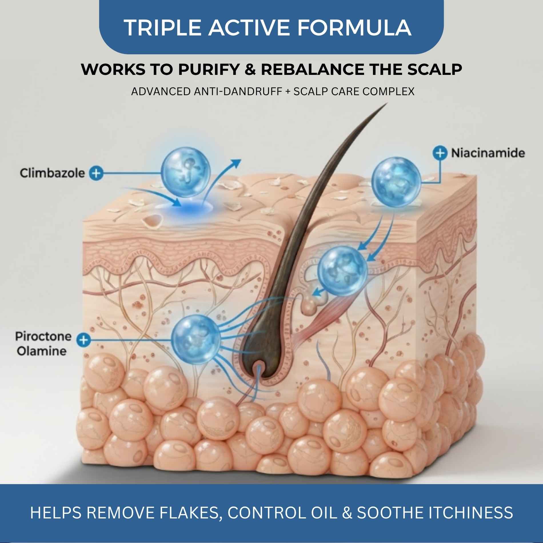 Dandruff - 3 steps - Shampoo+Exfoliating Scalp Serum+Hair Mask - The Skin Story -