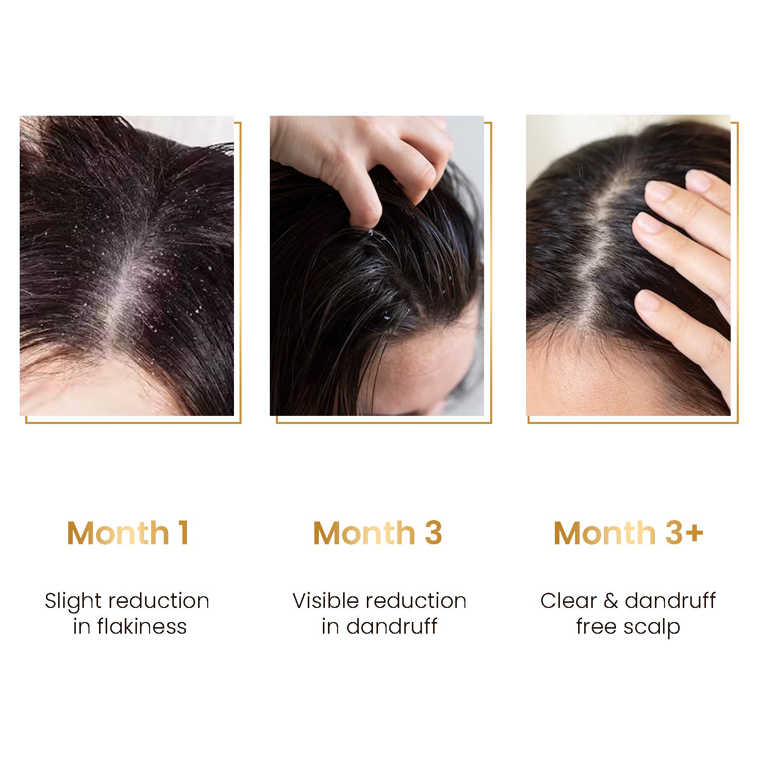 Anti-Dandruff Scalp Serum