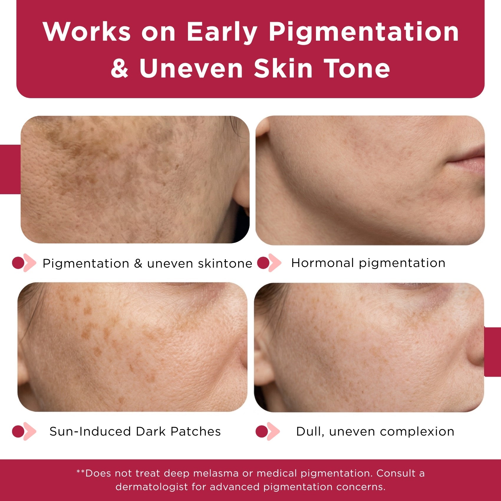 Dull & Uneven Skin Tone - 2 Step with Facewash+10% Vitamin C Face Serum - The Skin Story -