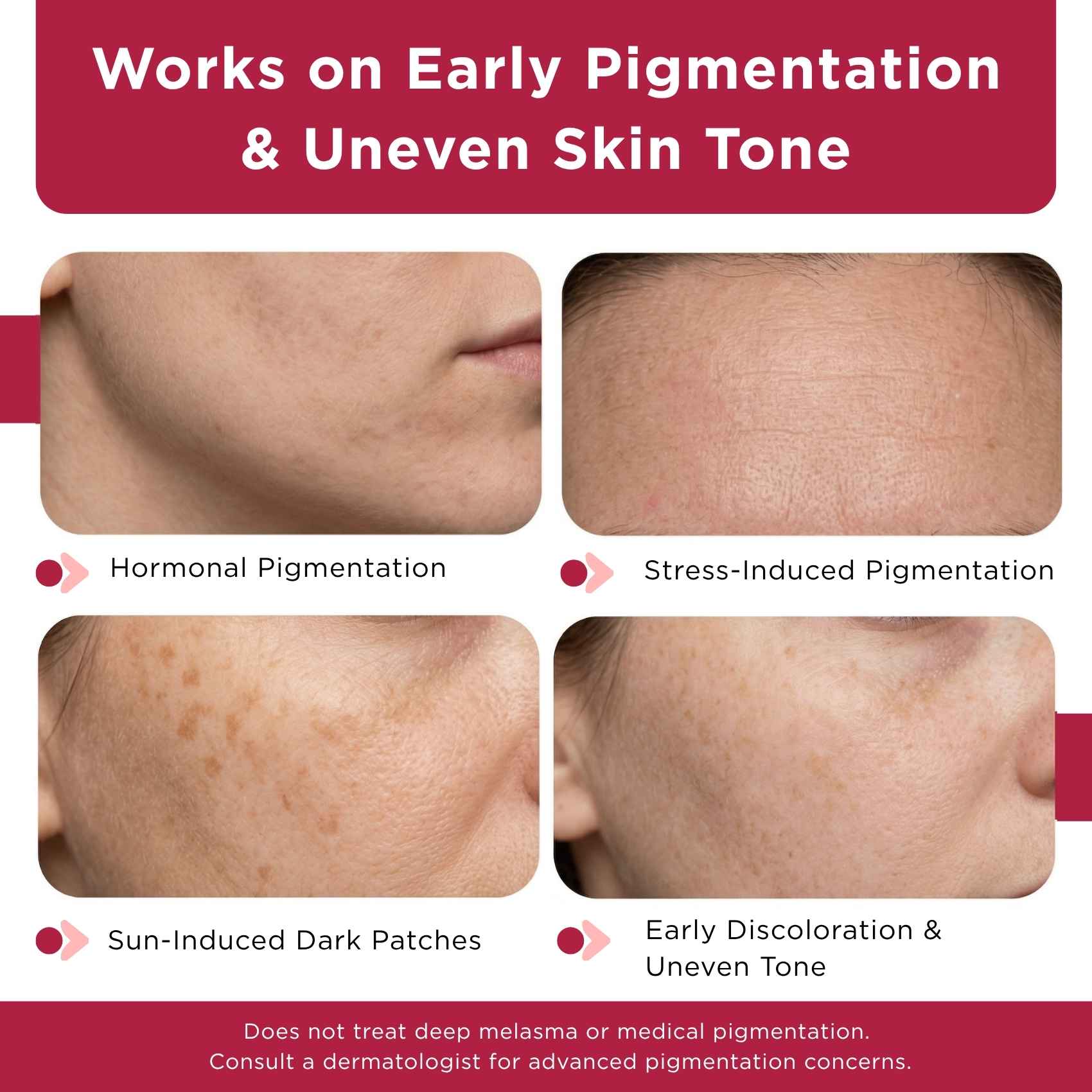 Early Onset Pigmentation 2 steps - Facewash+Corrector Serum - The Skin Story -