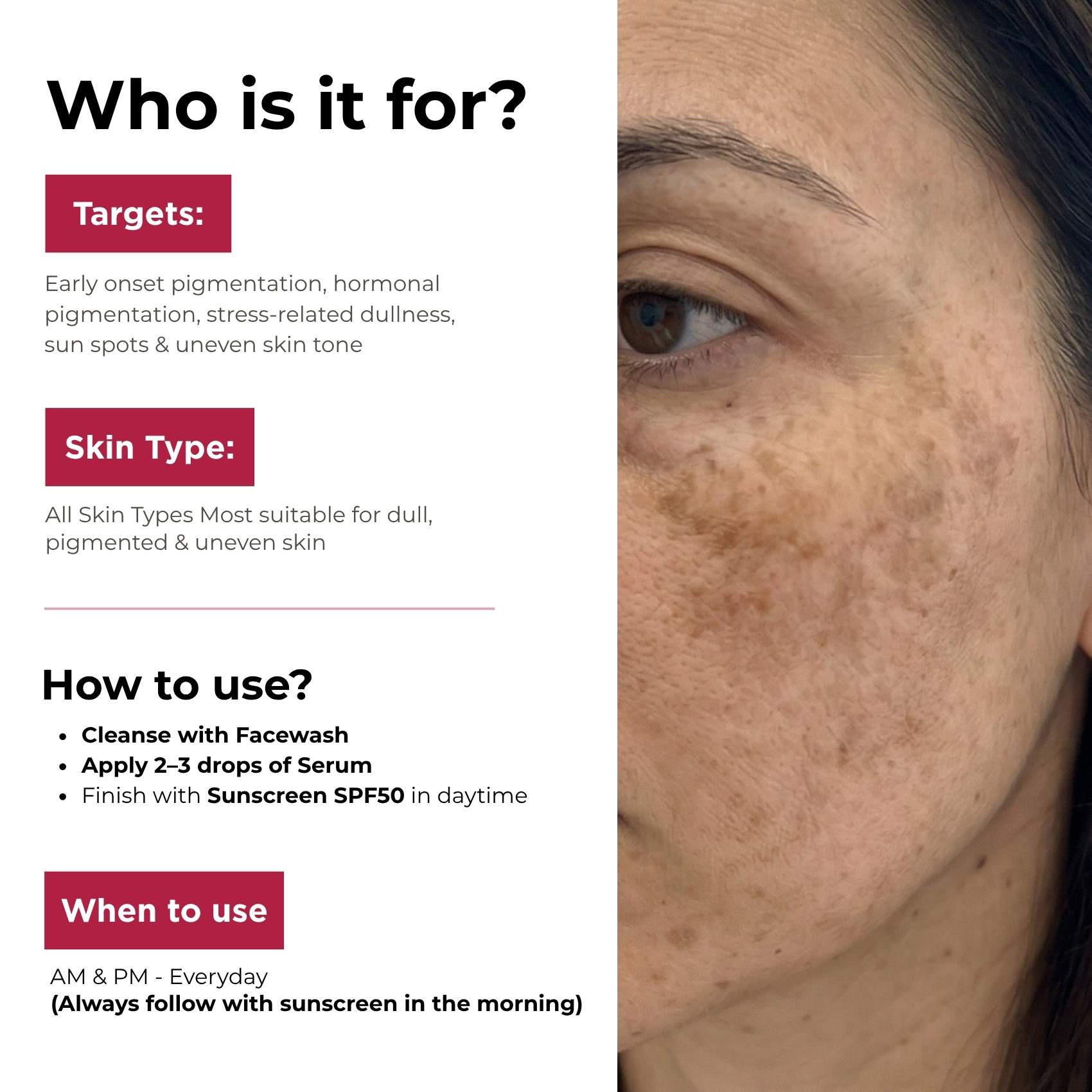 Early Onset Pigmentation 3 steps - Facewash+Corrector Serum+Sunscreen SPF50 - The Skin Story -