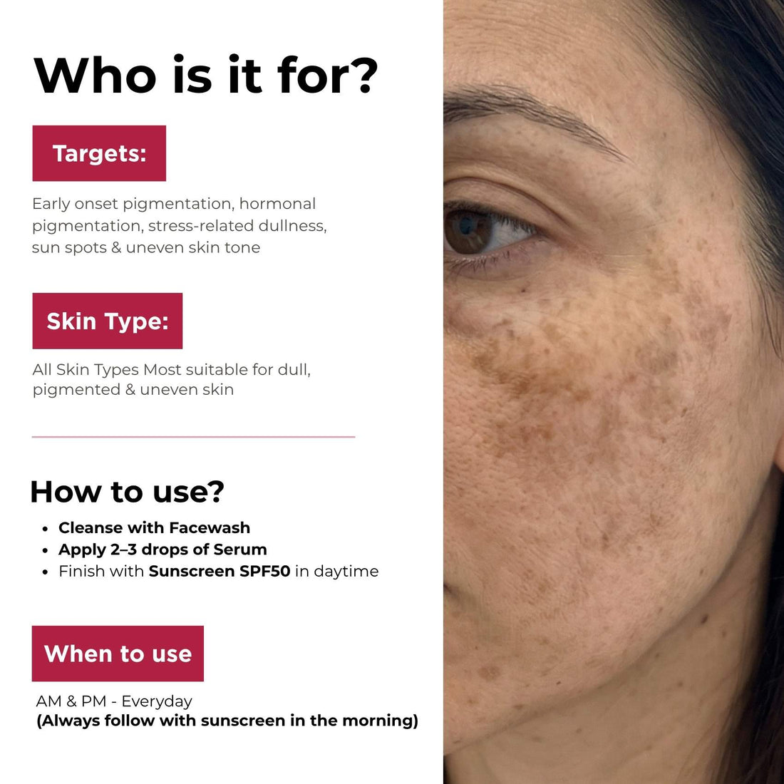 Early Onset Pigmentation 3 steps - Facewash+Corrector Serum+Sunscreen SPF50 - The Skin Story -