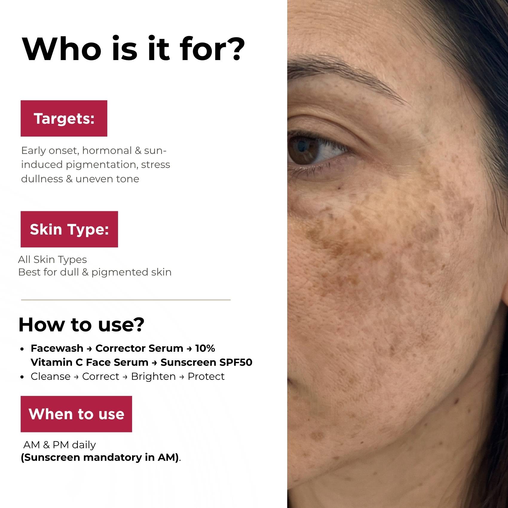 Early Onset Pigmentation 4 steps - Facewash+Corrector Serum+10% Vitamin Serum+Sunscreen SPF50 - The Skin Story -