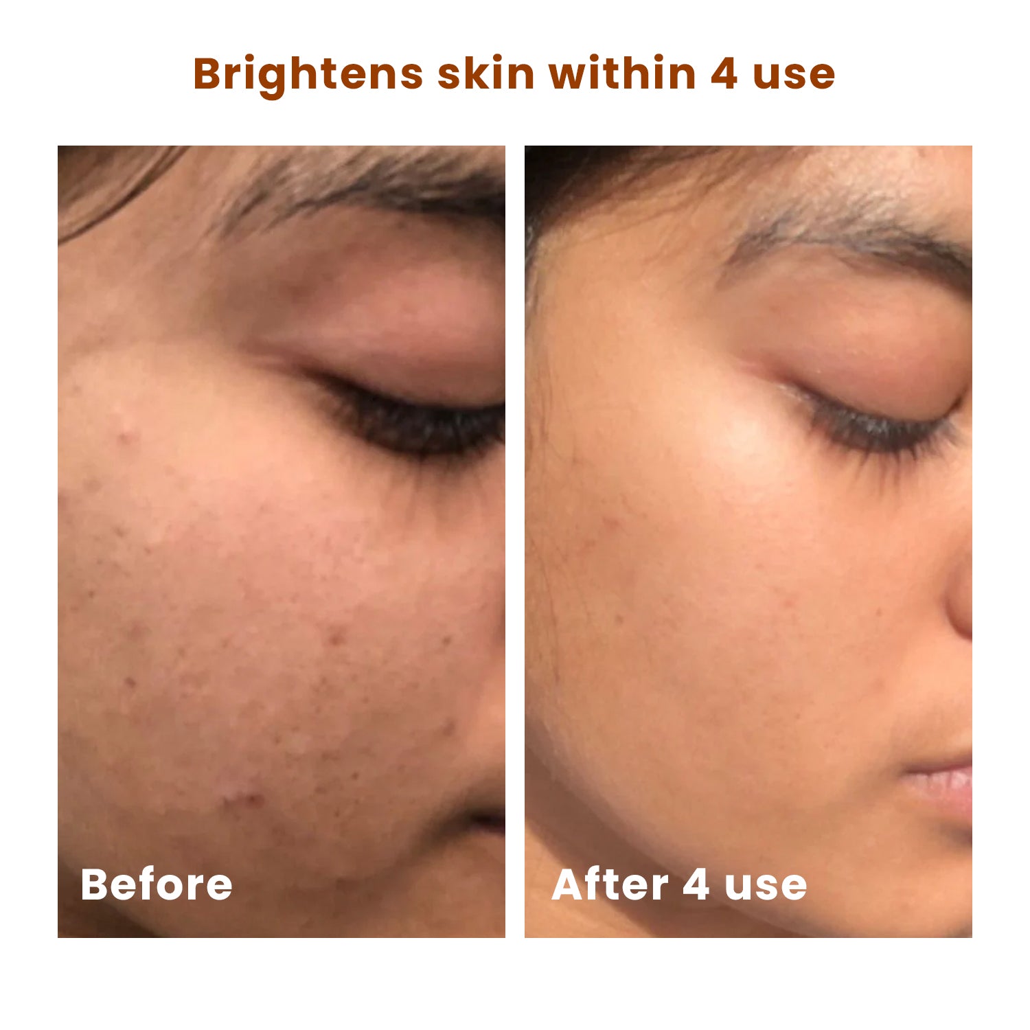 Brightening Scrub | Exfoliates & Hydrates | Evens Skin Tone & Boosts Glow | 100g