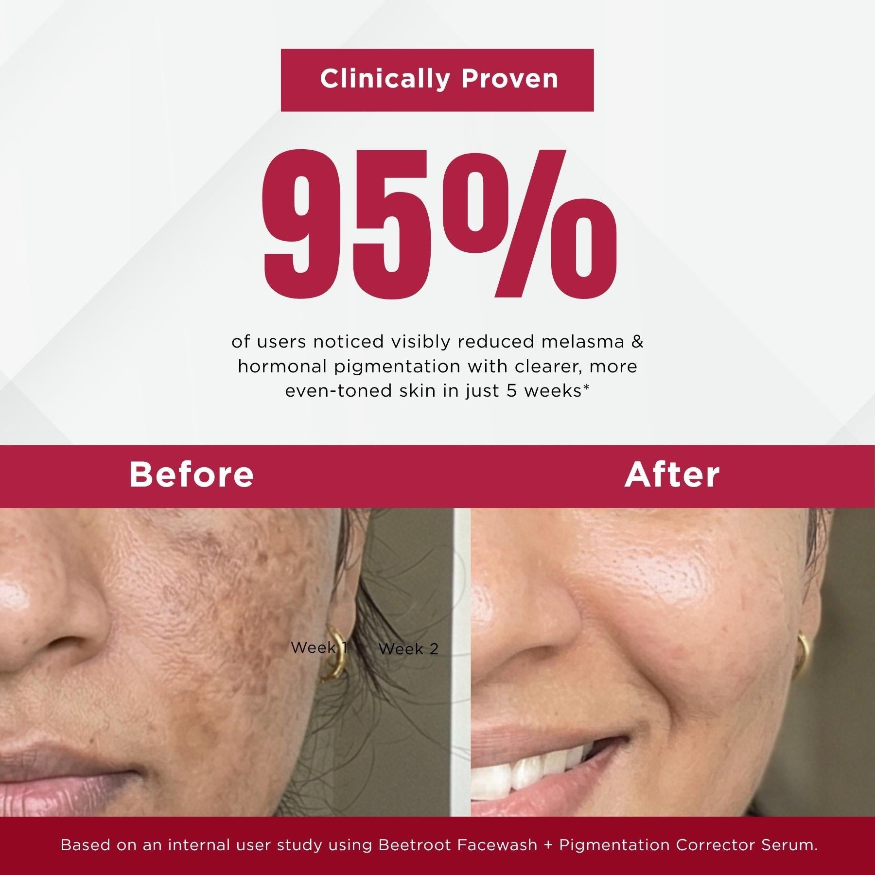 Melesma 3 Steps - Facewash+Serums - The Skin Story -