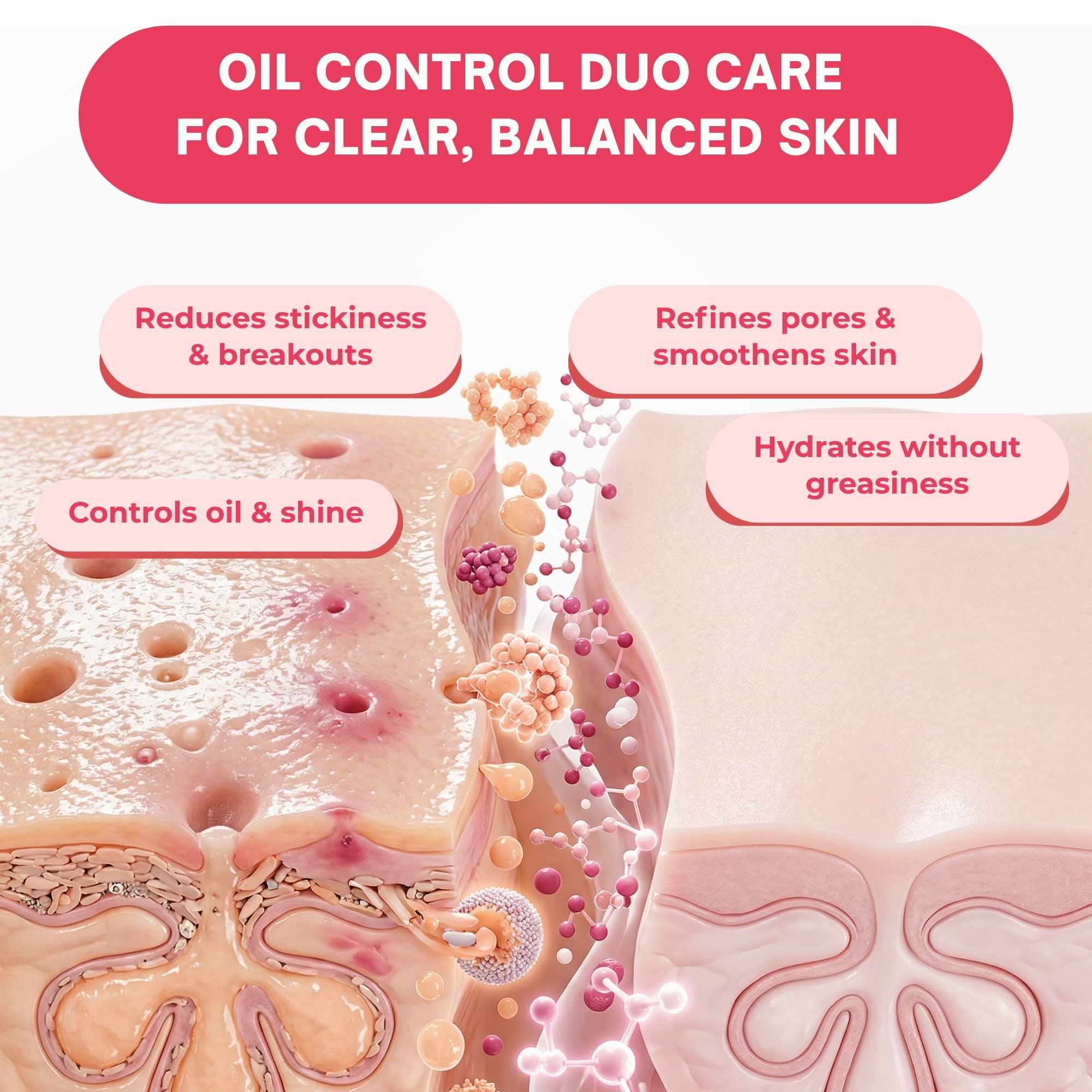 Oil Control 3 Steps - Facewash+Toner+Moisturiser - The Skin Story -