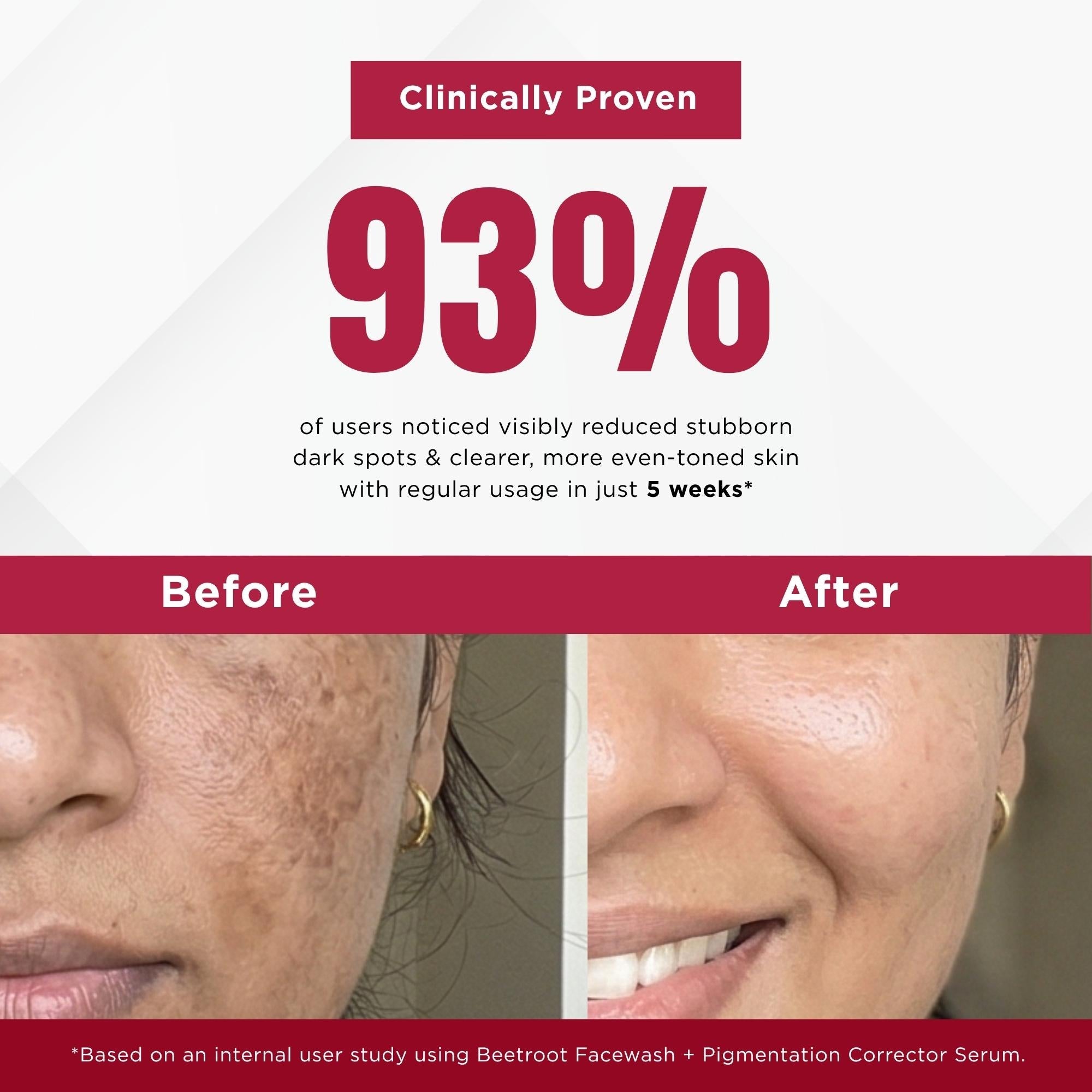 Stuborn Dark Spots 2 Steps - Facewash+Serum - The Skin Story -