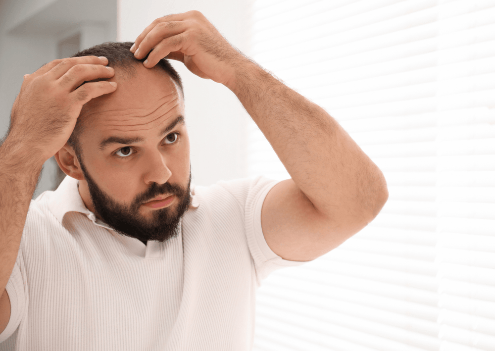 7 Early Signs of a Receding Hairline: What to Look Out For - The Skin Story