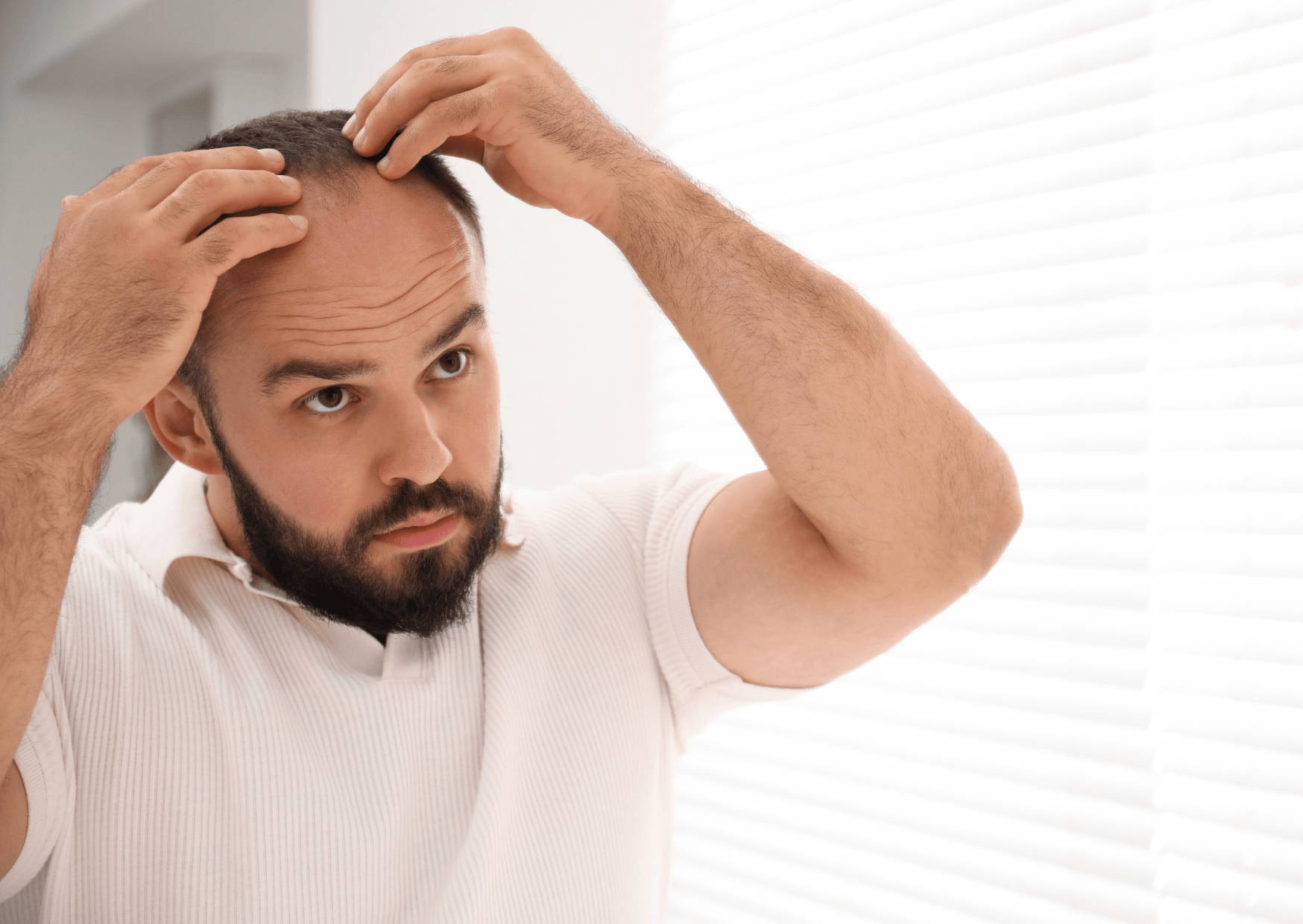 7 Early Signs of a Receding Hairline: What to Look Out For - The Skin Story