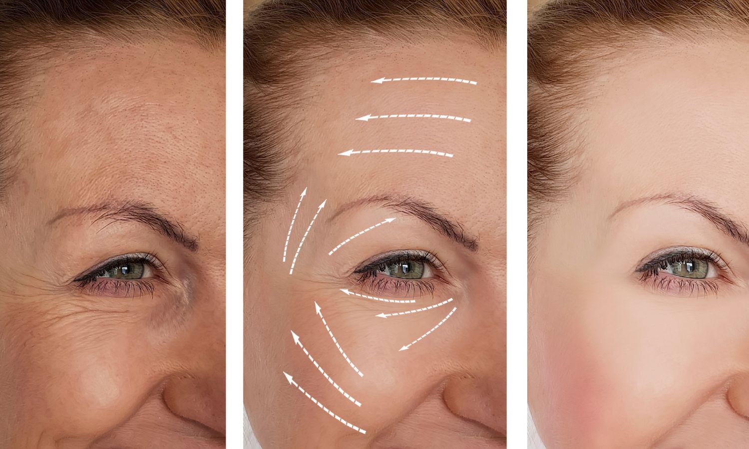 Achieving Bright, Clear Skin with The Skin Story Pigmentation Corrector Serum and a 45-Days Healthy Skin Challenge - The Skin Story