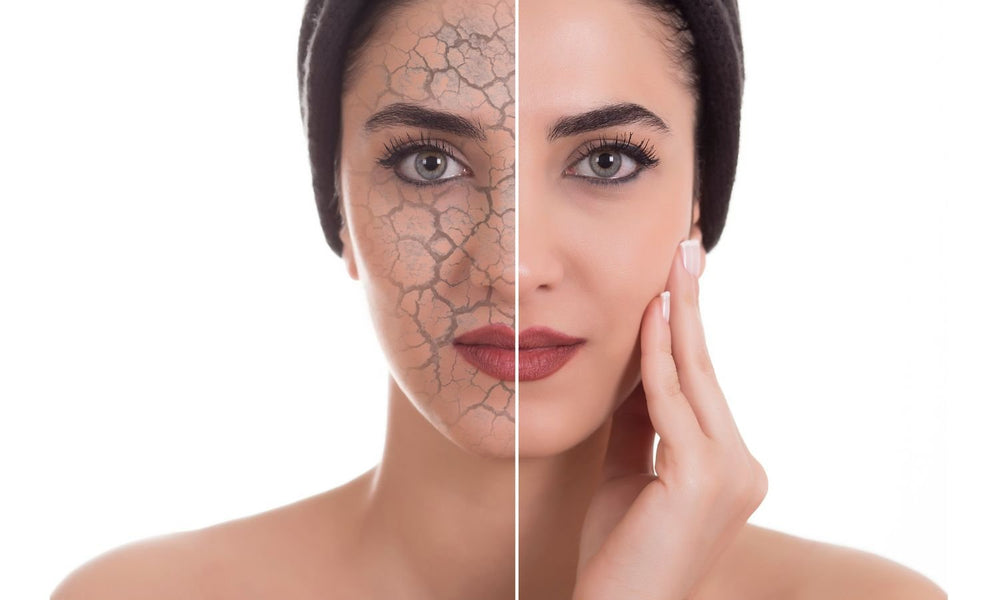 Dry Skin Morning Routine - The Skin Story