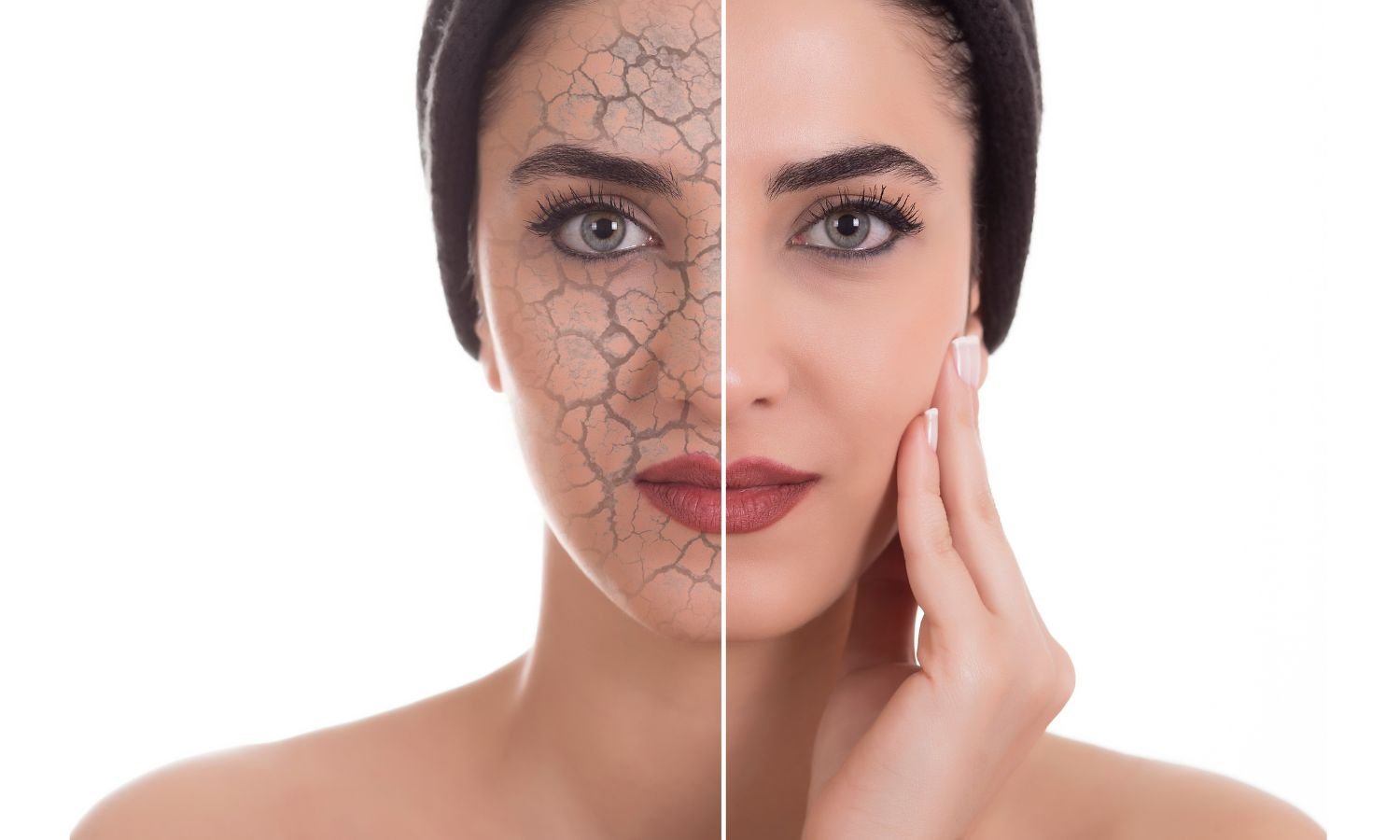 Dry Skin Morning Routine - The Skin Story