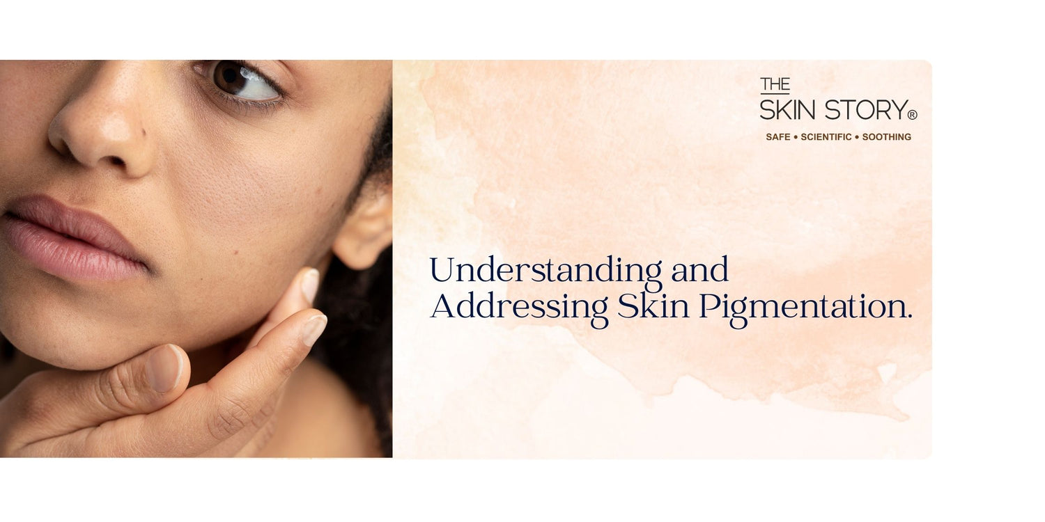 Understanding and Addressing Skin Pigmentation