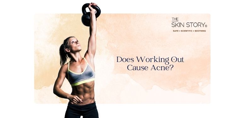 Does Working Out Cause Acne?