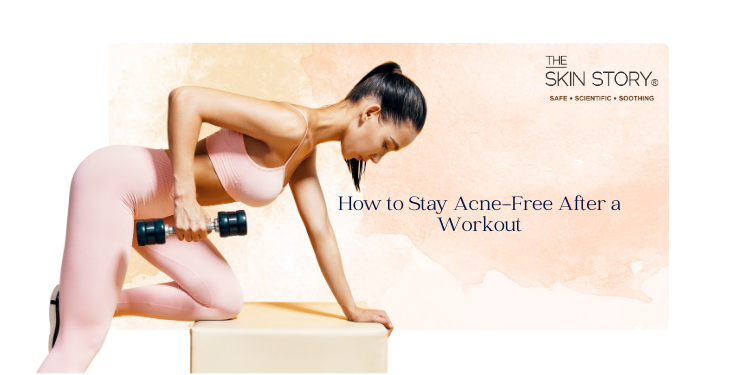How to Stay Acne-Free After a Workout