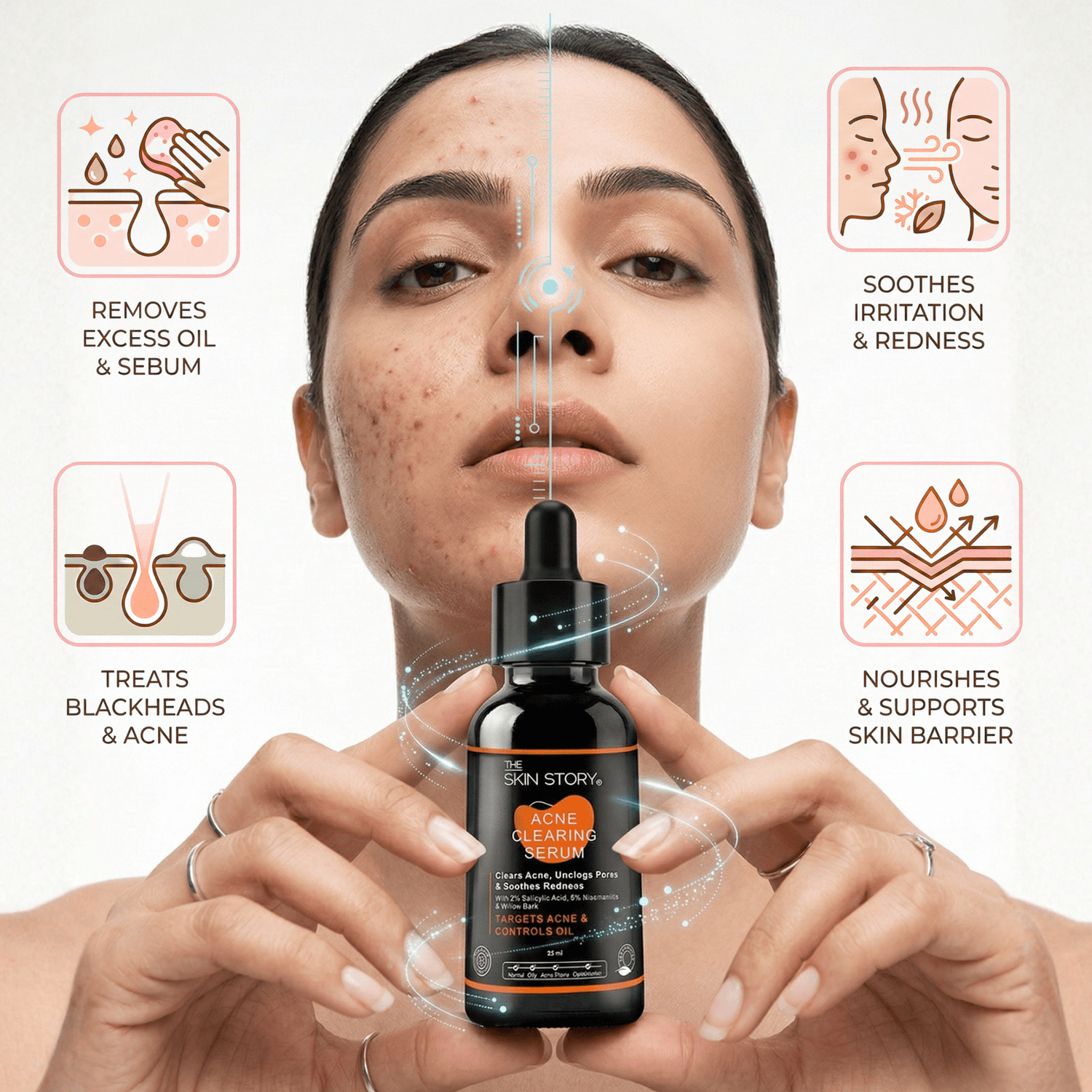 2 Step Acne Clear Regime with Facewash &amp; Serum - The Skin Story - Facewash
