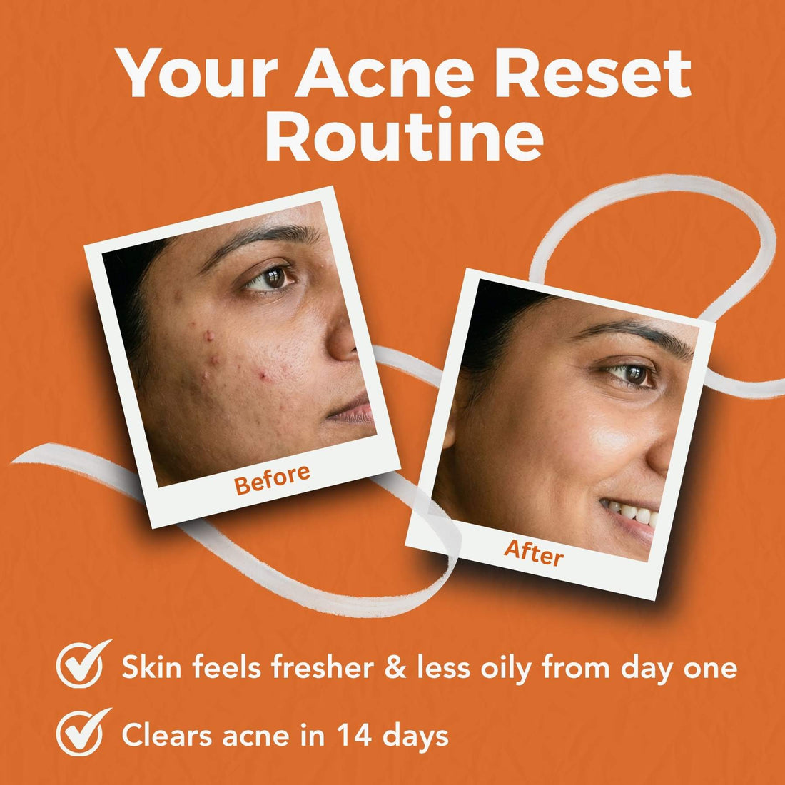 2 Step Active Acne + Marks Regime with Serums - The Skin Story - 