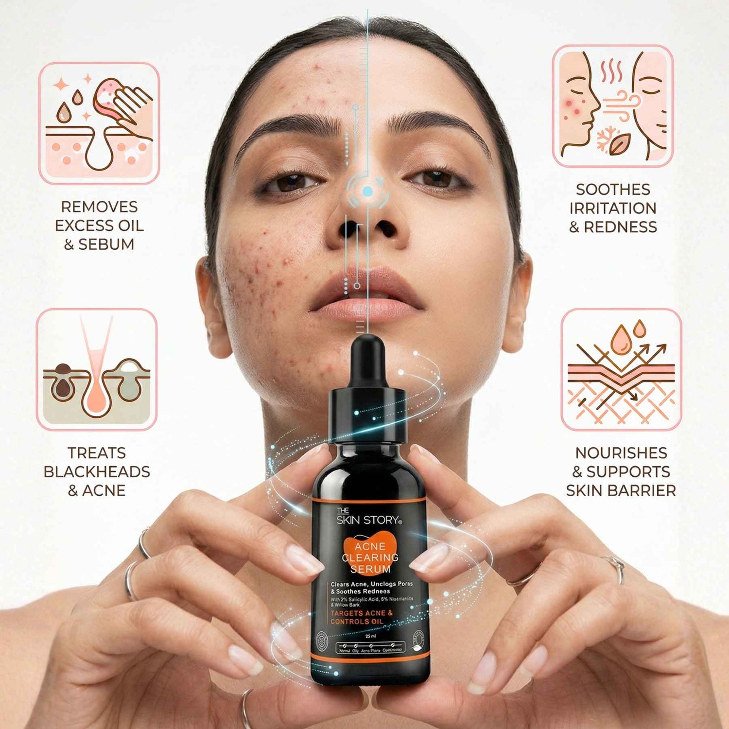 2 Steps PCOD Acne Regime with Facewash &amp; Serums - The Skin Story - 