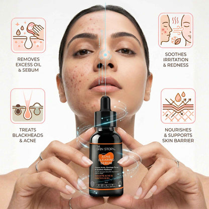2 Steps PCOD Acne Regime with Facewash &amp; Serums - The Skin Story - 