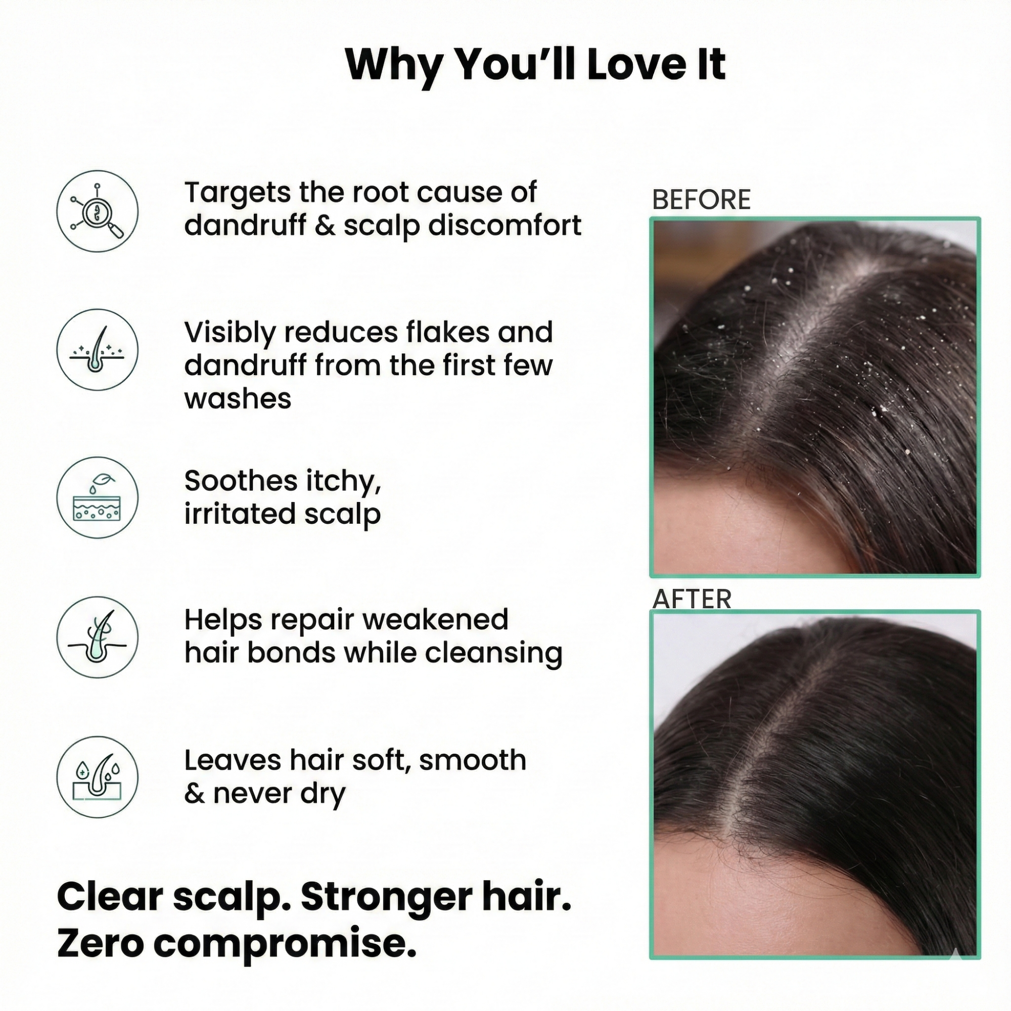 Anti-Dandruff Shampoo