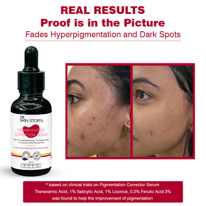 Anti - Pigmentation Combo