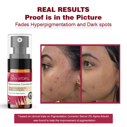 Pigmentation Corrector, Anti Pigmentation Serum For Even and Brighter Skin