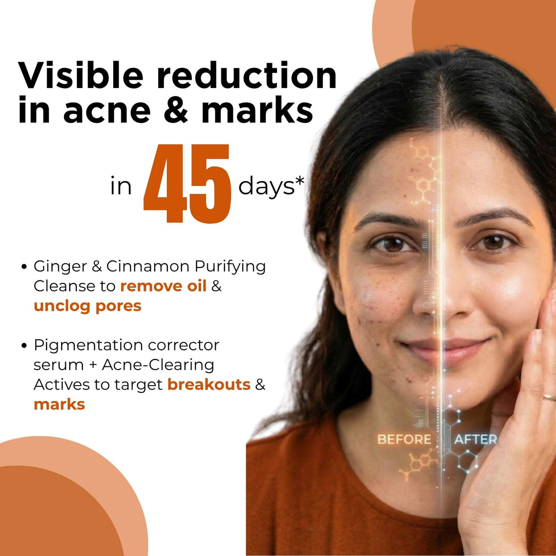 3 Step Acne + Marks Clear Regime with Facewash &amp; Serums - The Skin Story - 