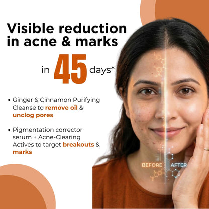 3 Step Acne + Marks Clear Regime with Facewash &amp; Serums - The Skin Story - 