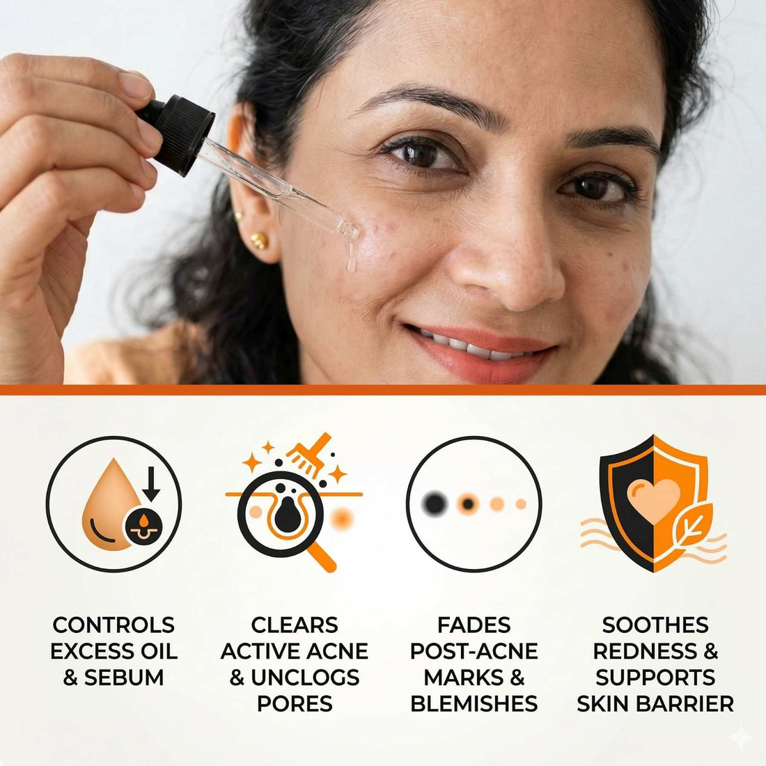 3 Step Acne + Marks Clear Regime with Facewash &amp; Serums - The Skin Story - 