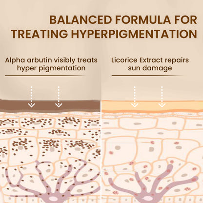 Pigmentation Corrector, Anti Pigmentation Serum For Even and Brighter Skin