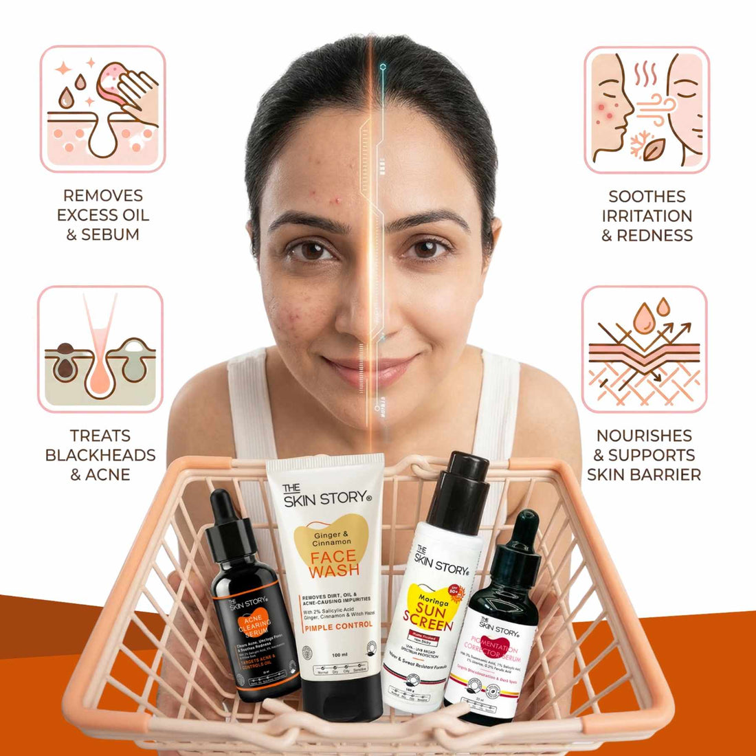 4 Steps PCOD Acne Regime with Facewash, Serums &amp; Sunscreen SPF50 - The Skin Story - 