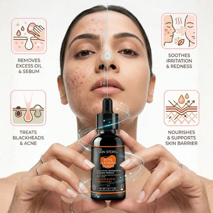 The Skin Story Acne Clearing Serum, 25ml