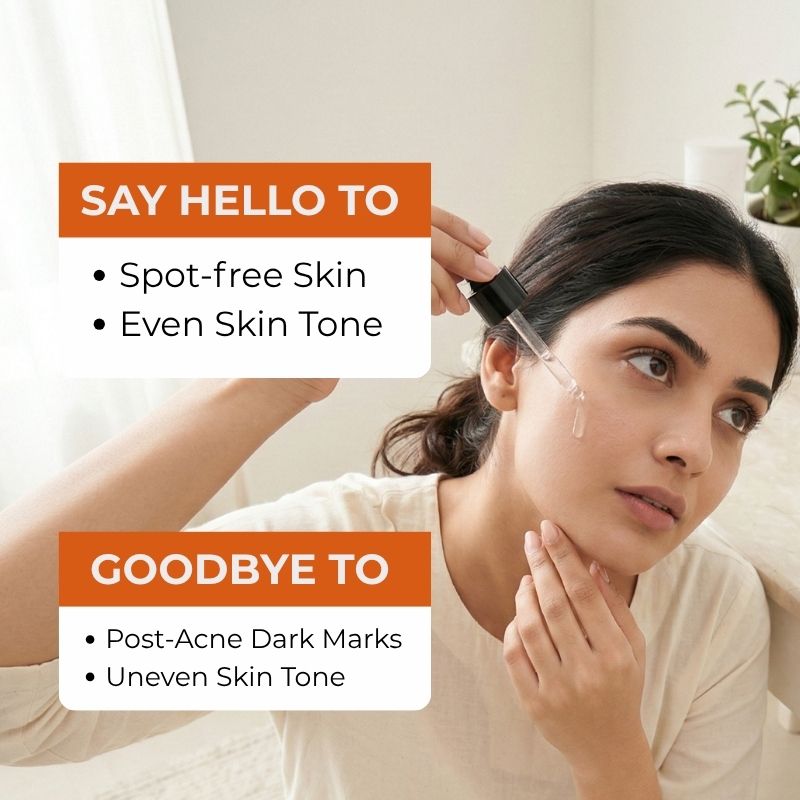The Skin Story Acne Clearing Serum, 25ml