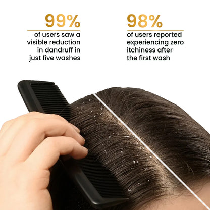 Anti Dandruff Shampoo Flake-Free with 0.5% Climbazole &amp; 1% Niacinamide 250ml
