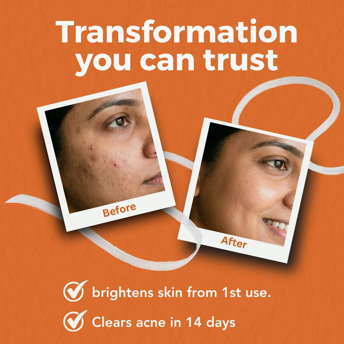 5 Step Acne + Marks Clear Regime with Facewash, Scrub, Serums &amp; Sunscreen SPF50 - The Skin Story - 