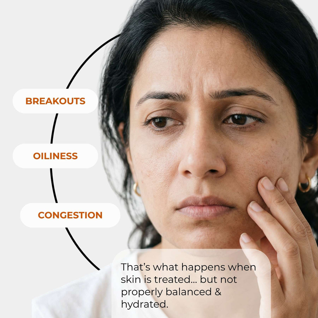 5 - Step Starter Routine with Facewash, Toner, Scrub, Serum &amp; Moisturiser - The Skin Story - 
