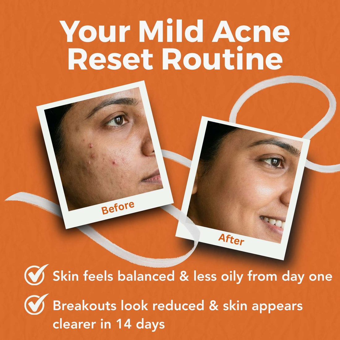 5 - Step Starter Routine with Facewash, Toner, Scrub, Serum &amp; Moisturiser - The Skin Story - 