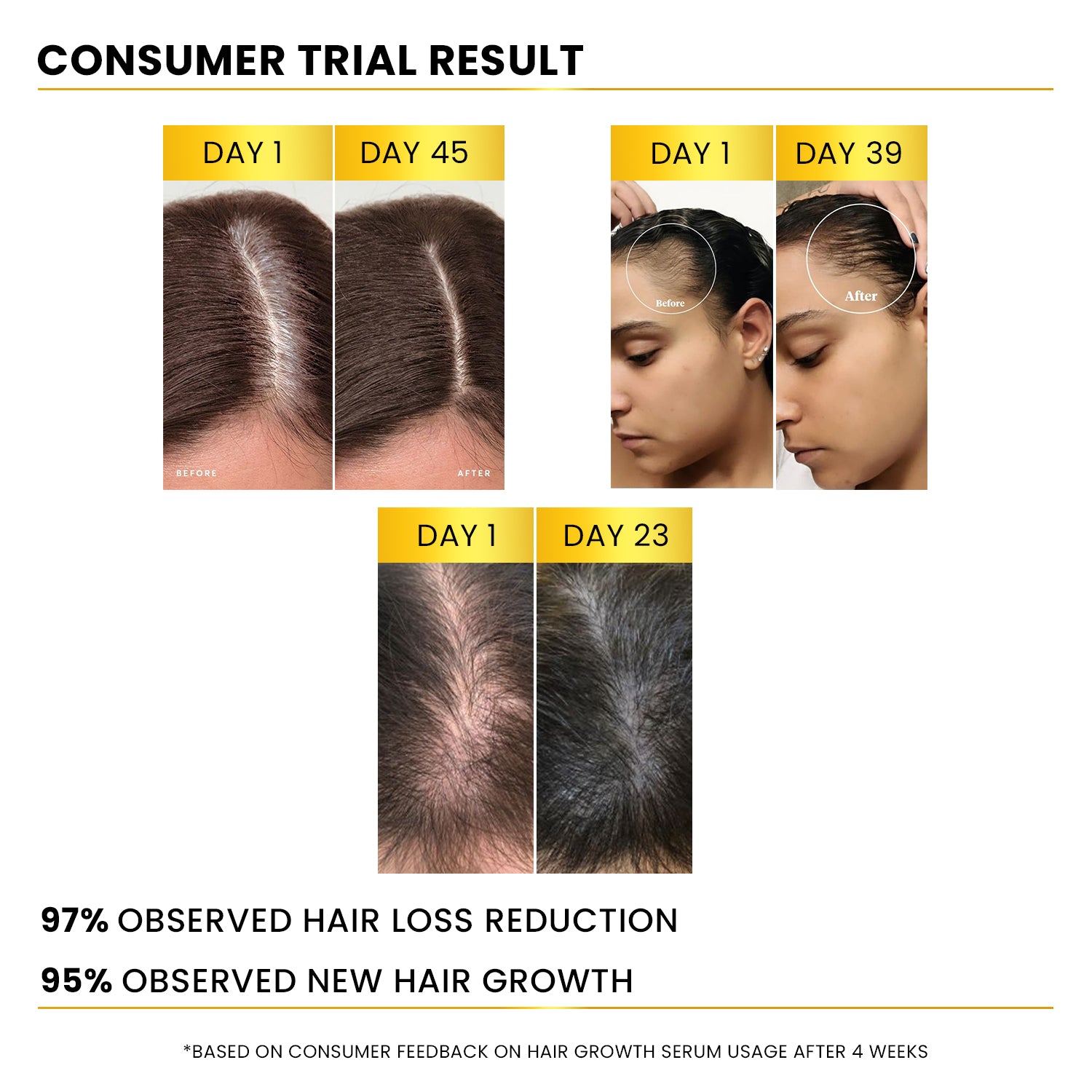 Advanced Hair Growth Serum 3% Redensyl®️ + 2% Rosemarry + 1% Hair Line, 25ml
