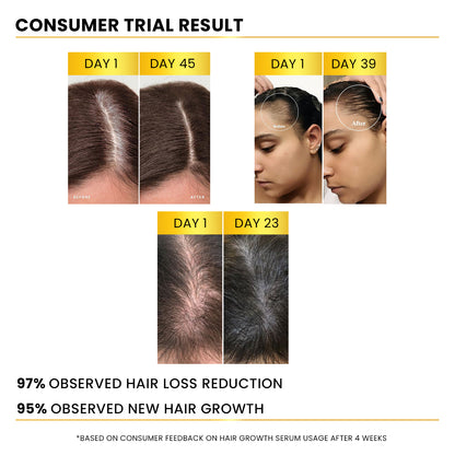 Advanced Hair Growth Serum 3% Redensyl®️ + 2% Rosemarry + 1% Hair Line, 25ml